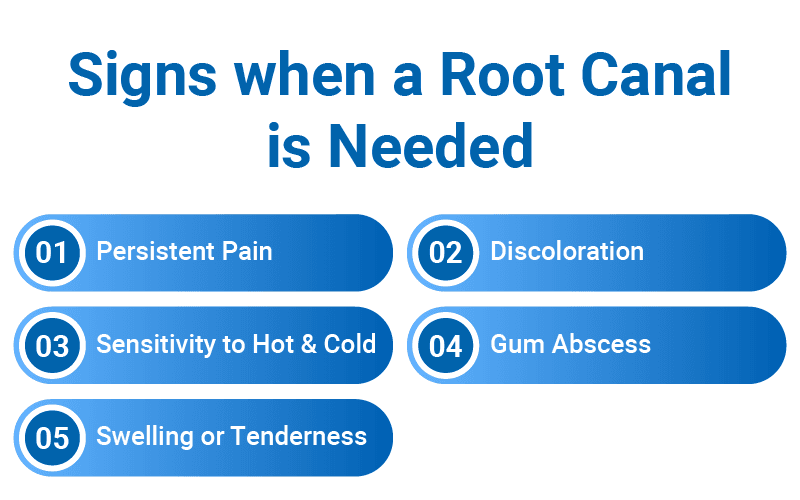 Signs A Root Canal is Needed ?