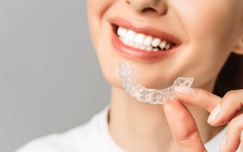 Types of Retainers
