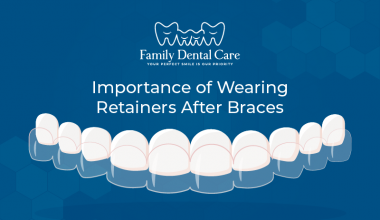 The Importance of Wearing Retainers After Braces