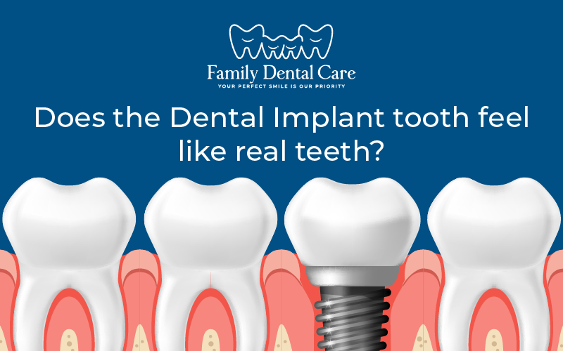 Does the dental implant tooth feel like real teeth?