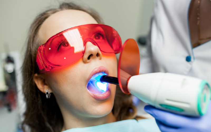 Teeth Whitening Solutions for Sensitive Teeth