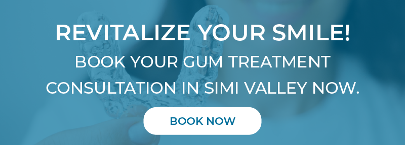 Gum Treatment Consultation in Simi Valley