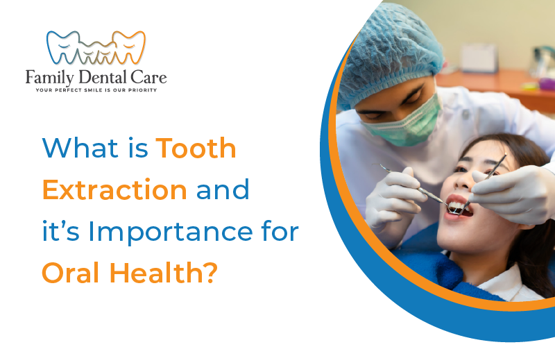 What is Tooth Extraction