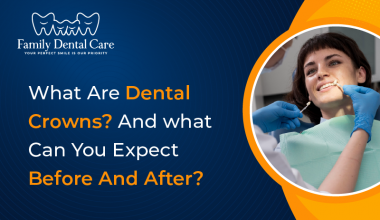 What Are Dental Crowns And what Can You Expect Before And After