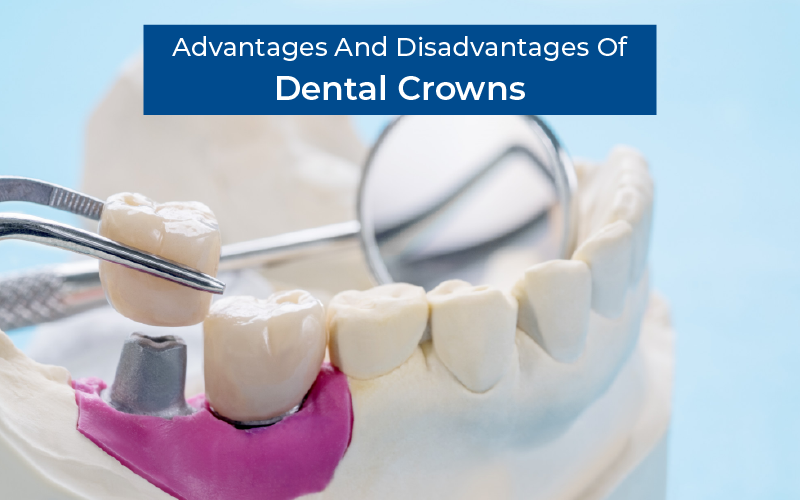 What Are The Advantages And Disadvantages Of Dental Crowns